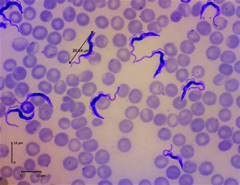  Trypanosoma: Ein mikroskopischer Wanderer durch den Blutkreislauf!